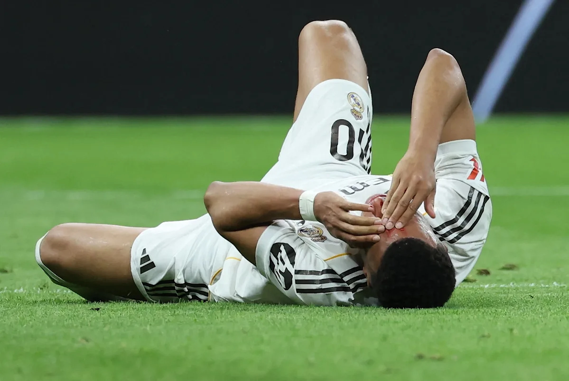 🤕 Mbappé, blood on his head! Arbeloa furious: Penalty, even on the moon 🤬 - Image 1