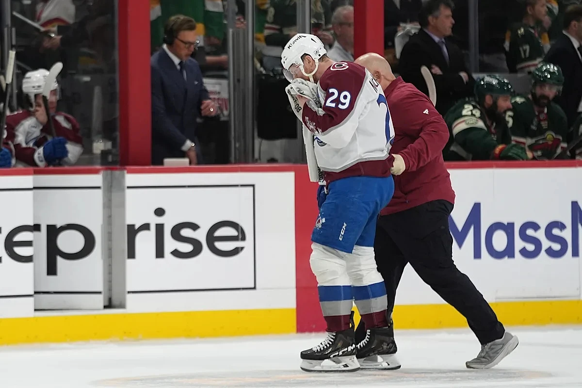 MacKinnon takes a puck from an Avs teammate to the face