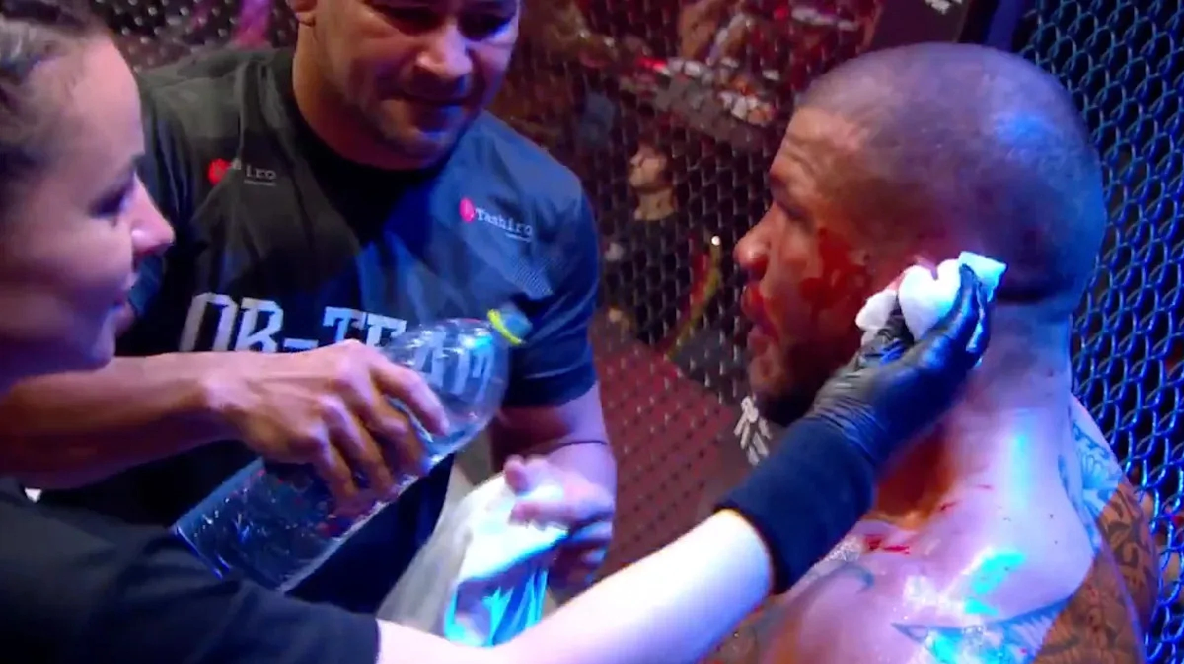 Missed Fists: Valmir da Silva loses fight after cauliflower ear explodes